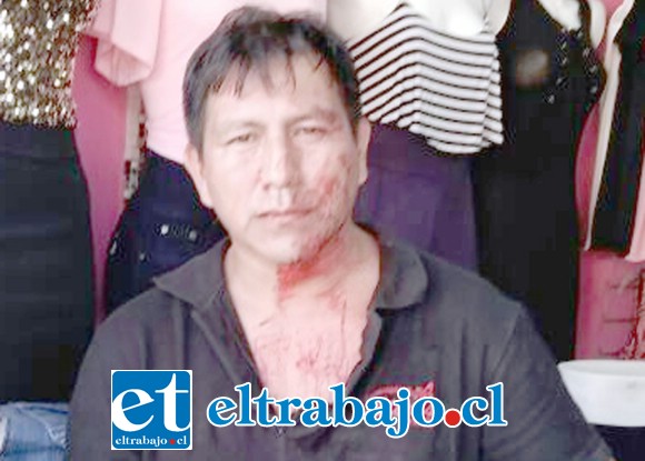 Edgar Pérez Quispe, propietario de la tienda, con el rostro bañado en sangre tras la violenta agresión.