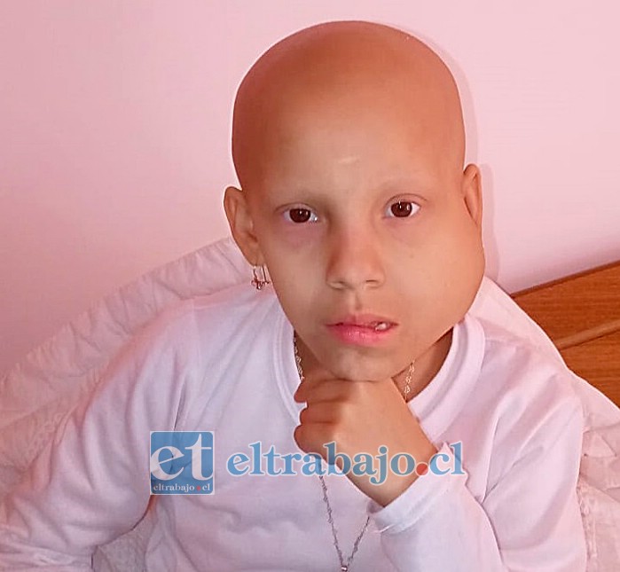 NUNCA SE RINDE.- Ella es Sofía Olguín, tiene 9 años de edad y desde 2019 enfrenta serios problemas de salud con este tumor.