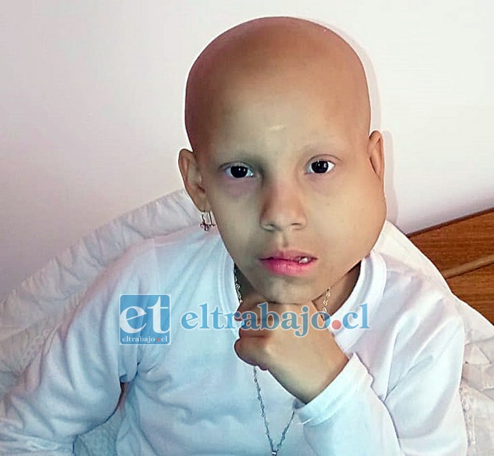 NUNCA SE RINDE.- Ella es Sofía Olguín, tiene 9 años de edad y desde 2019 enfrenta serios problemas de salud con este tumor.