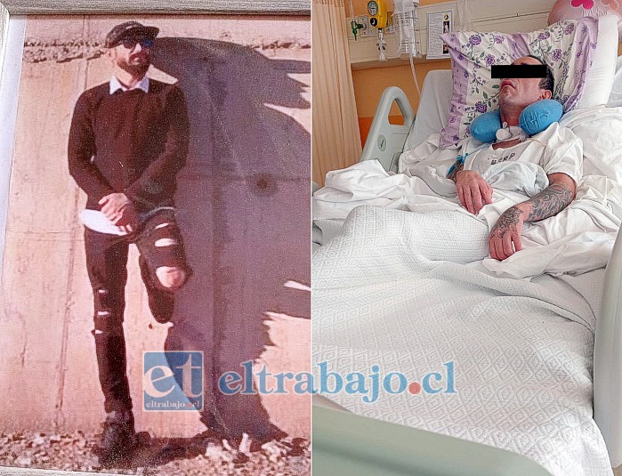 A la izquierda, Michael Vargas, antes del accidente. A la derecha, su estado actual: postrado en cama y hospitalizado en Putaendo, hasta donde su familia debe viajar para visitarlo.