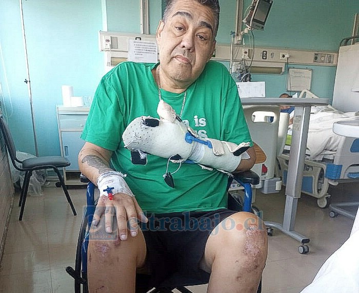 Israel Gallardo, en su sillas de ruedas antes del infarto que lo mantiene al borde de la muerte.