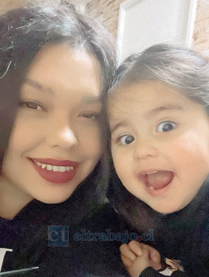 Allison Álvarez junto a su hija Samatha, quien padece esta extraña enfermedad. (Fotografía cedida por su madre).