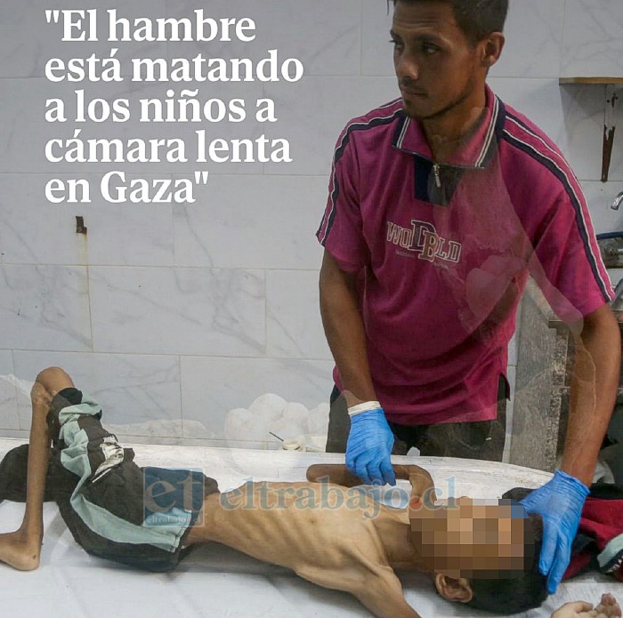 El hambre está matando en Gaza.