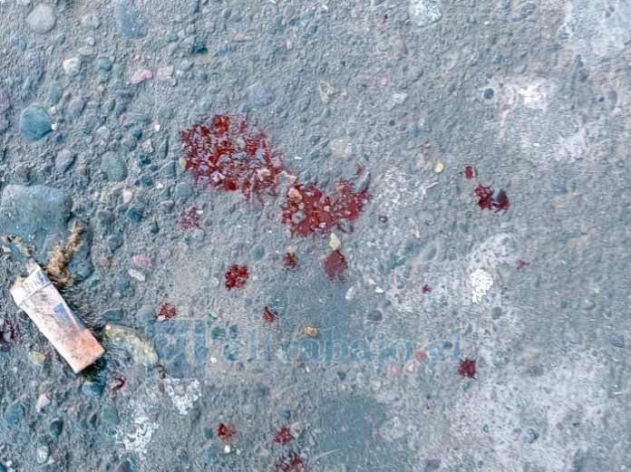 Muestras de sangre en el lugar.