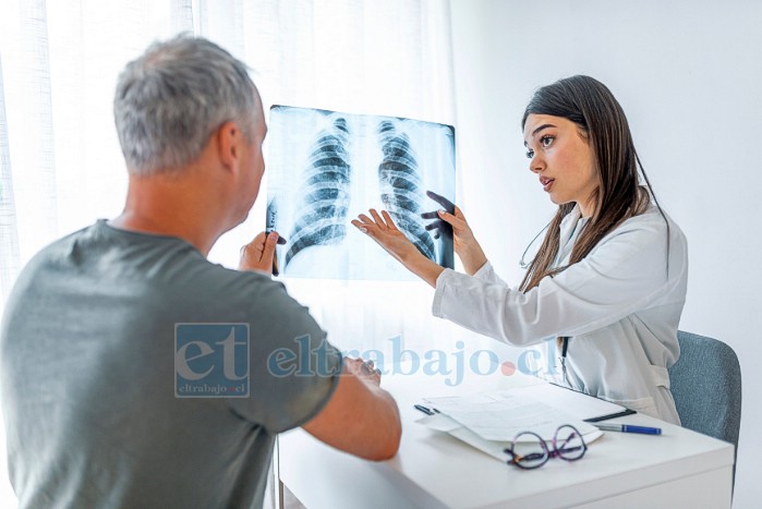 GES cubrirá tratamiento para dejar de fumar y prevenir cáncer de pulmón (Imagen referencial).