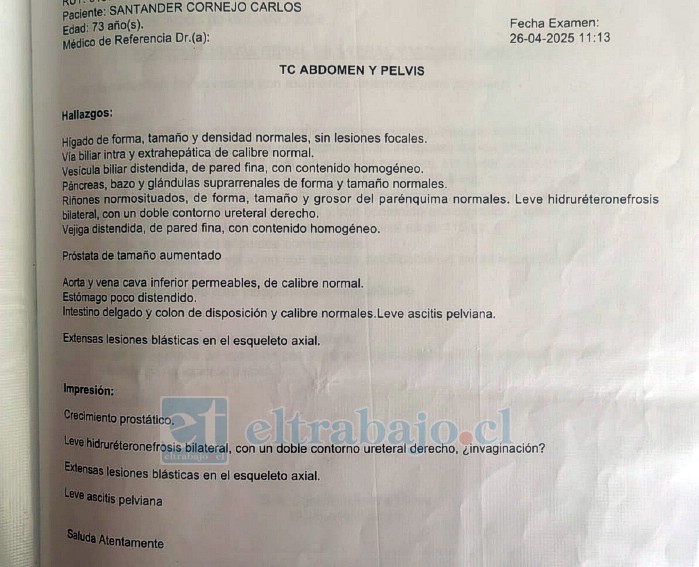 Este documento da cuenta que, en abril de 2025, ya existía una sospecha de cáncer de próstata.