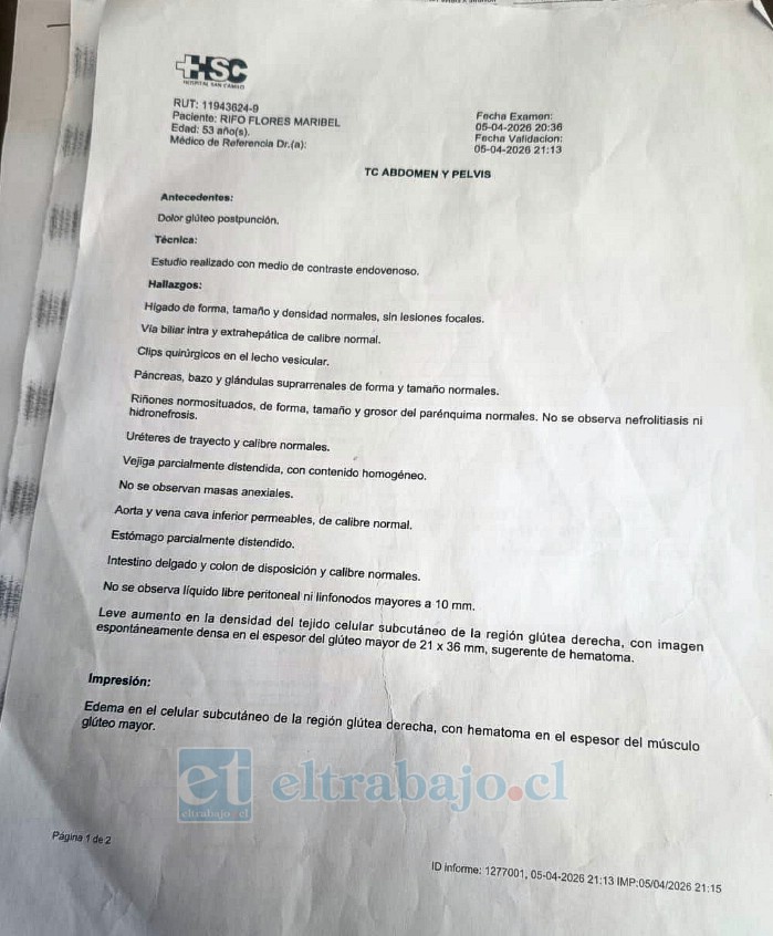 Informe de TC abdomen y pelvis  entregados en la Urgencia del Hospital San Camilo confirman diagnóstico de hematoma.