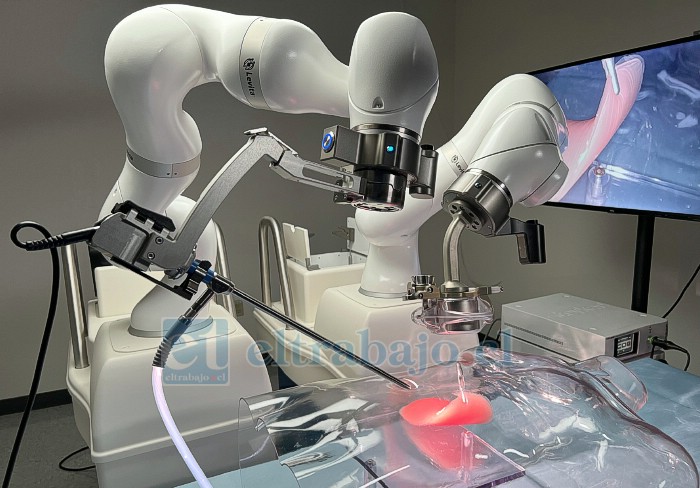 Robot quirúrgico asistido por imanes permitirá realizar cirugías abdominales con menos incisiones, reduciendo el dolor y los tiempos de recuperación en los pacientes.