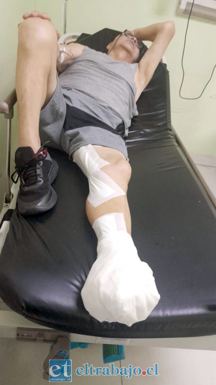 Claudio en el hospital, ya con su pie izquierdo amputado.