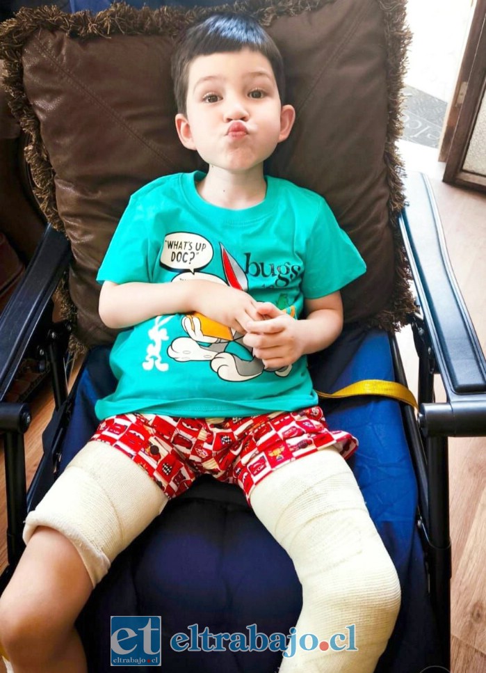 Ángel Martínez Lazcano continúa enfrentando las consecuencias del tumor en su fémur izquierdo, situación que actualmente limita su movilidad y requiere nuevos tratamientos.
