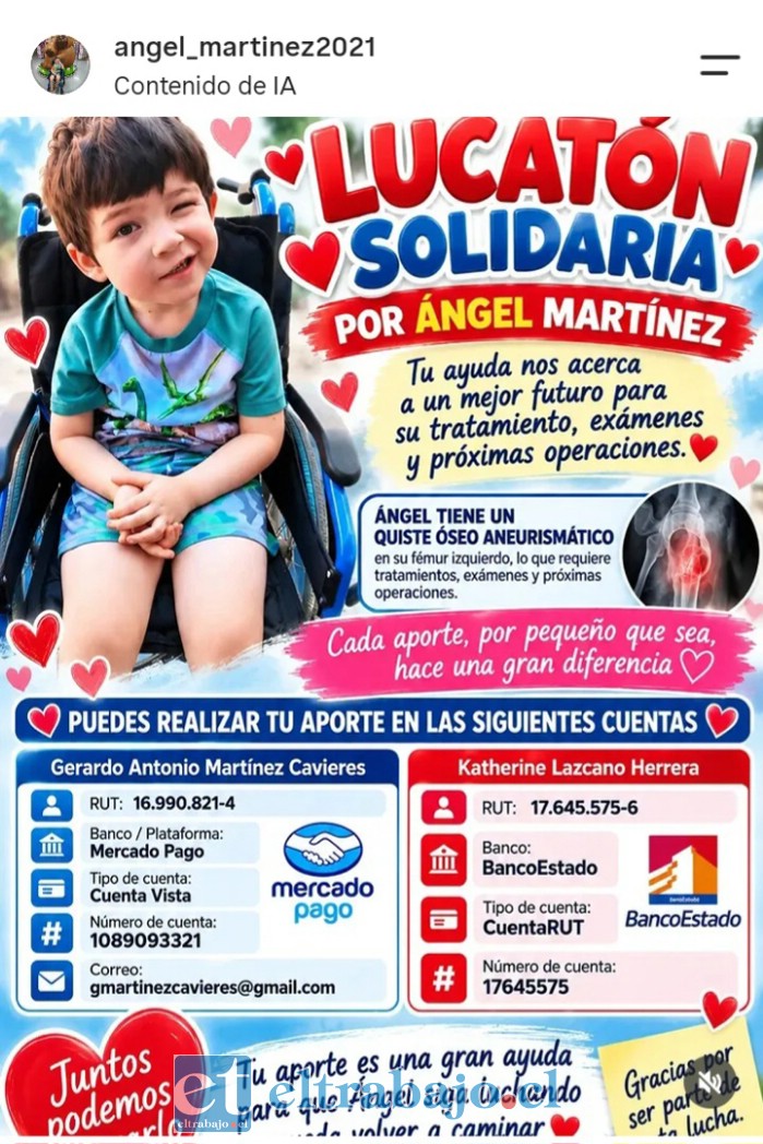 Uno de los tantos afiches para reunir dinero de la familia del pequeño de 5 años.