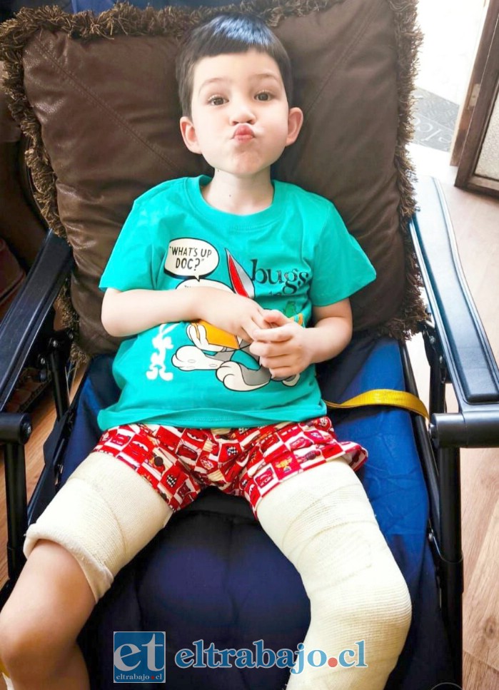 Ángel Martínez Lazcano continúa enfrentando las consecuencias del tumor en su fémur izquierdo, situación que actualmente limita su movilidad y requiere nuevos tratamientos